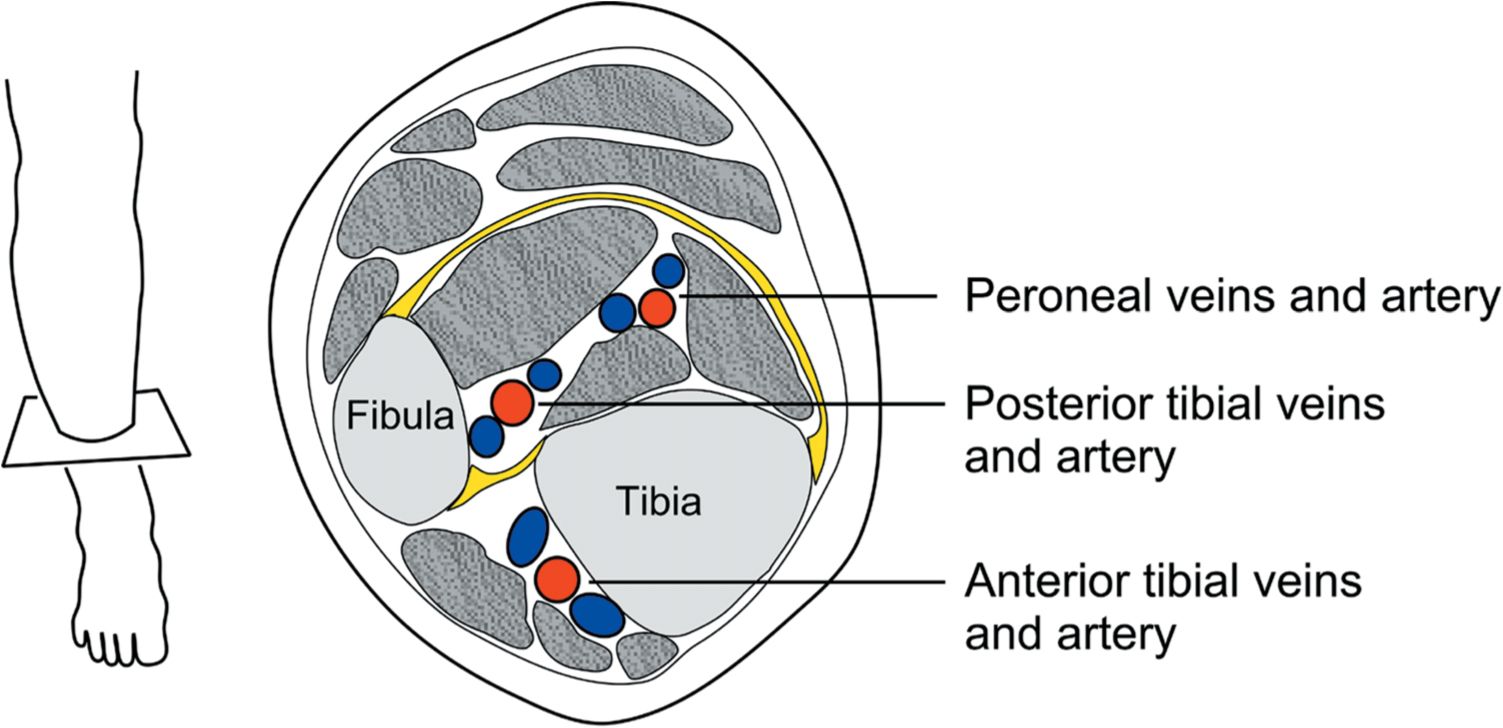 Venous Anatomy Plastic Surgery Key