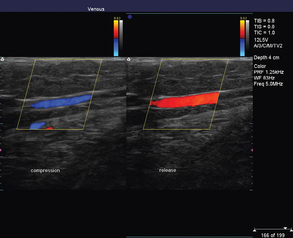 Venous Imaging/Duplex Ultrasound Plastic Surgery Key