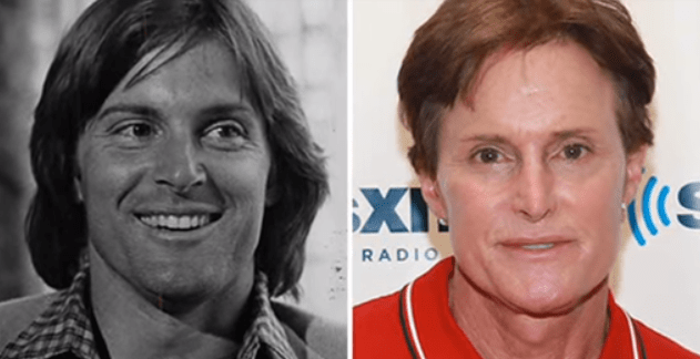 The Phenomenal and Shocking Transformation of Bruce Jenner Plastic