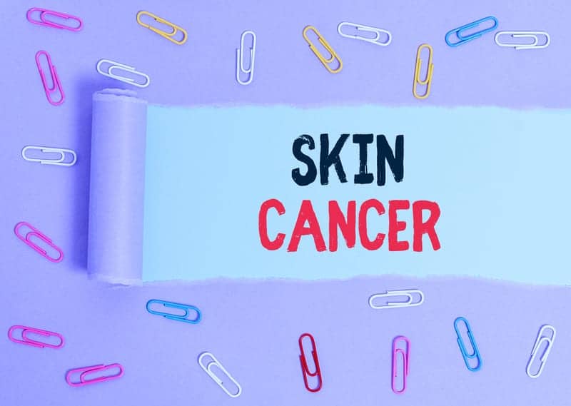 Immunotherapy Before Surgery Could Advance Care of an Aggressive Form