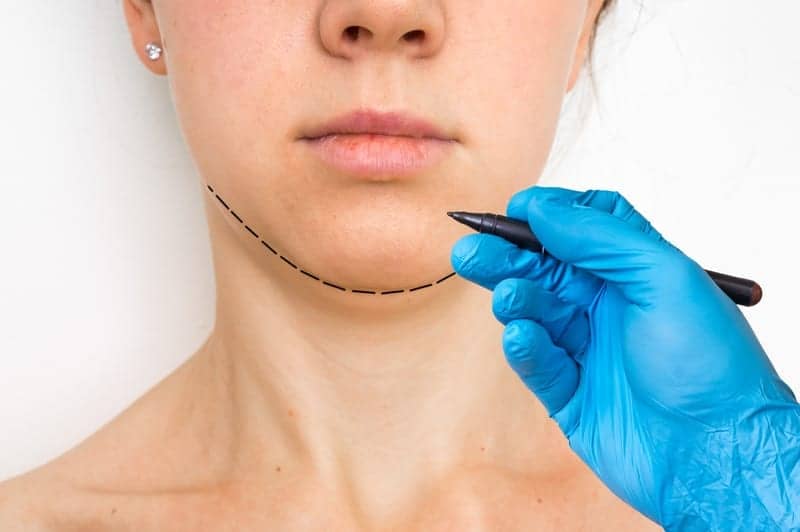 Is Chin Augmentation the New Nose Job? Plastic Surgery Practice