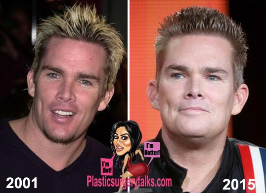 Mark Mcgrath Plastic Surgery Before & After - Plastic Surgery Talks