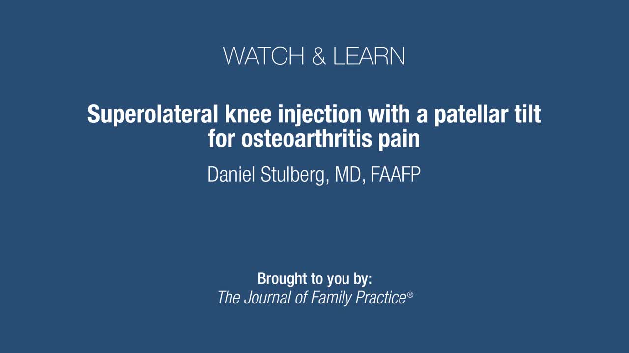 Superolateral knee injection with a patellar tilt for osteoarthritis