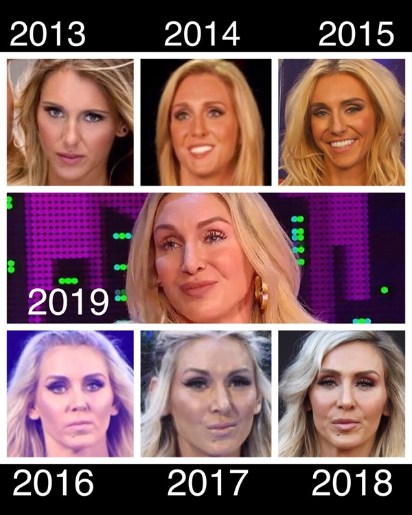 WWE Star Charlotte Flair Admitted to Getting Plastic Surgery Led by