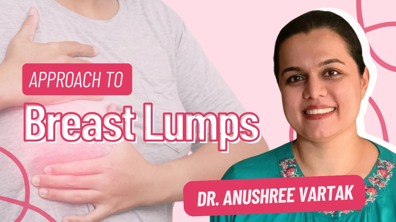 Approach to Breast Lumps in Practice Management on Medflix