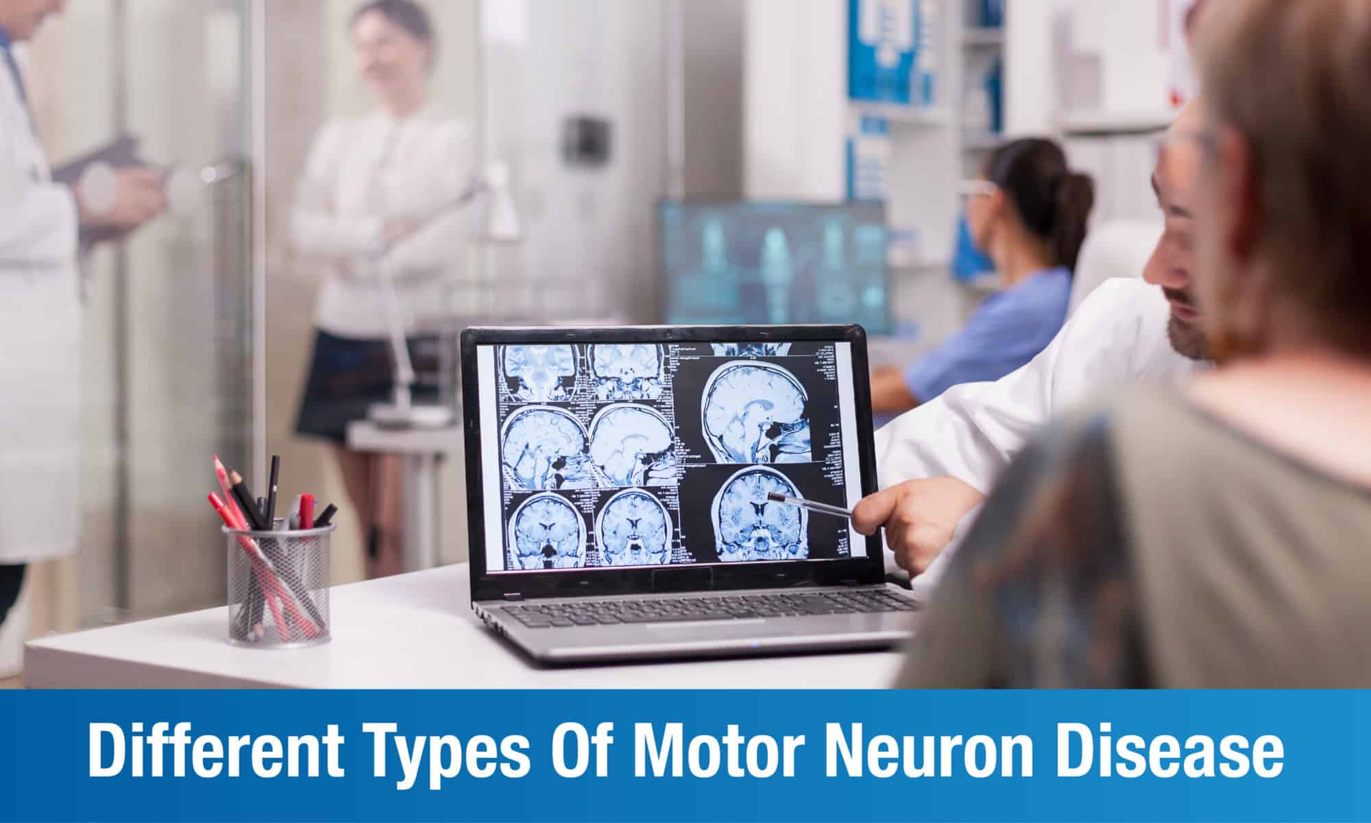 What are the different Types of Motor Neurone Disease(MND)? Plexus
