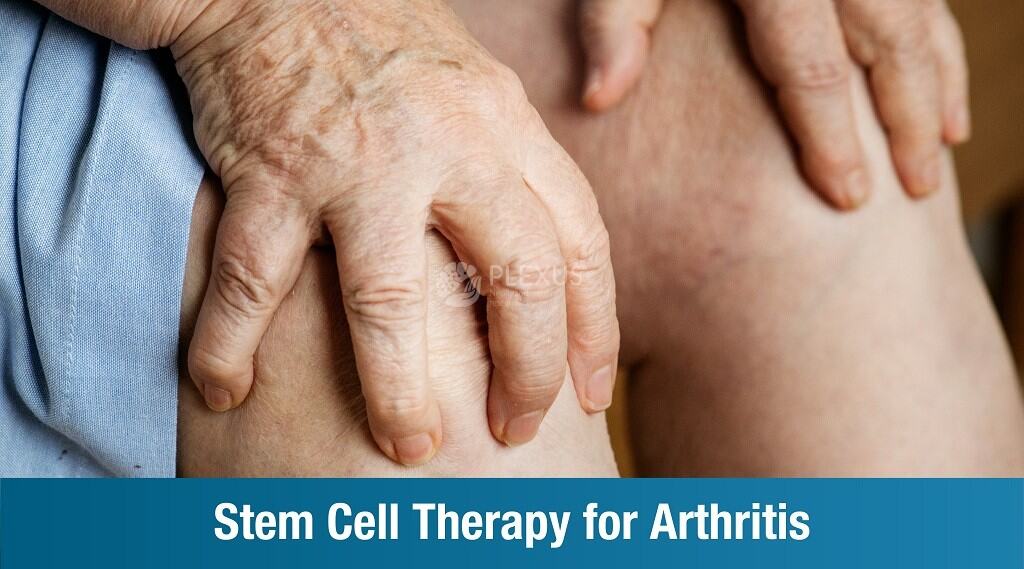 Stem Cell Therapy for Arthritis Plexus