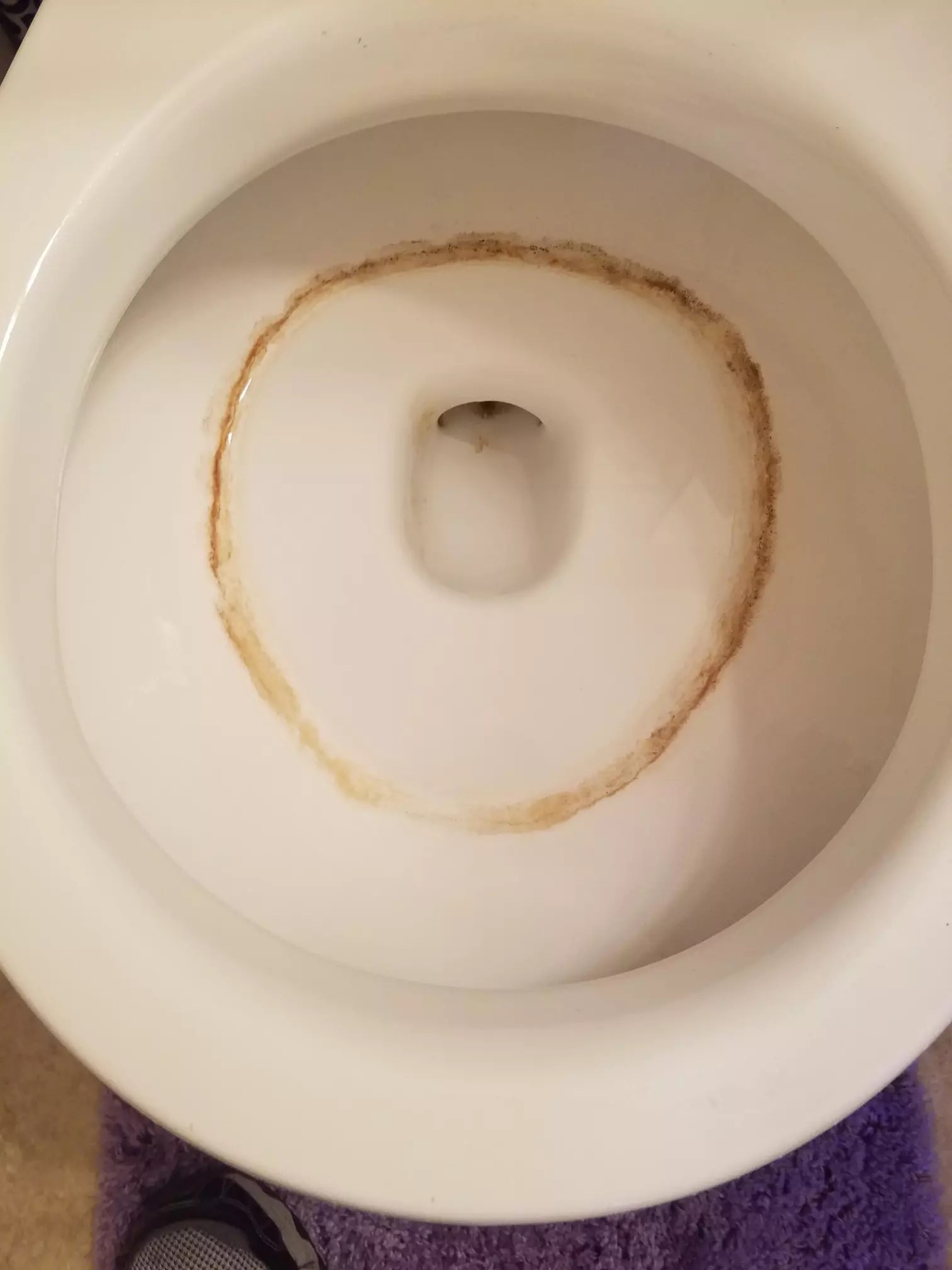What Causes Toilet Bowl Ring And How To Prevent It?