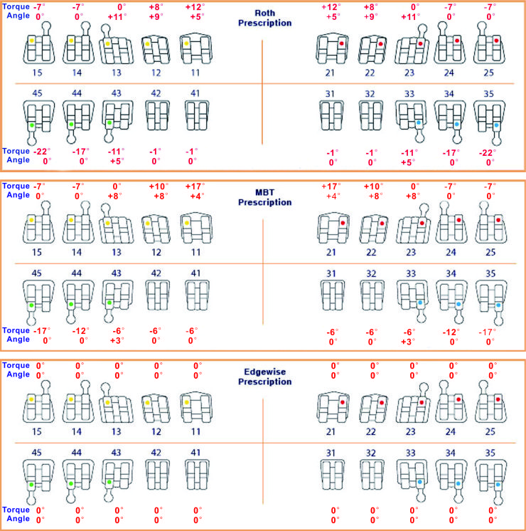 The differences among Roth, MBT and Edgewise brackets