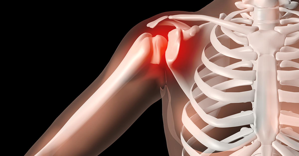 Nashville, TN Rotator Cuff Tear Dube Orthopedics