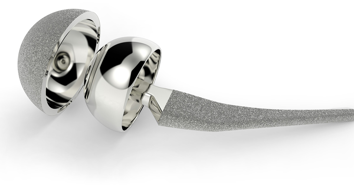 Total Hip Replacement (Metal on Metal) New Iberia, LA Orthopedic