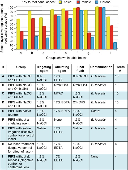 Irrigation of Root Canals Pocket Dentistry