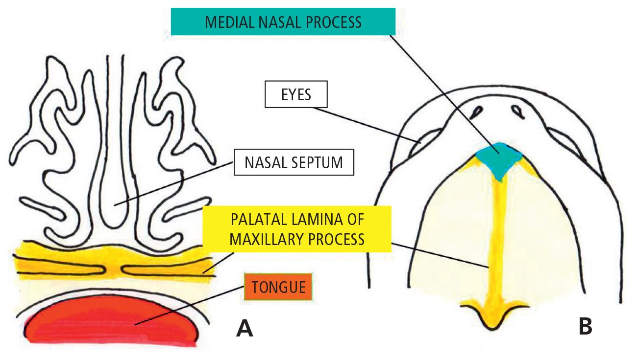 CRANIOFACIAL GROWTH IN CLEFT LIP AND PALATE Pocket Dentistry