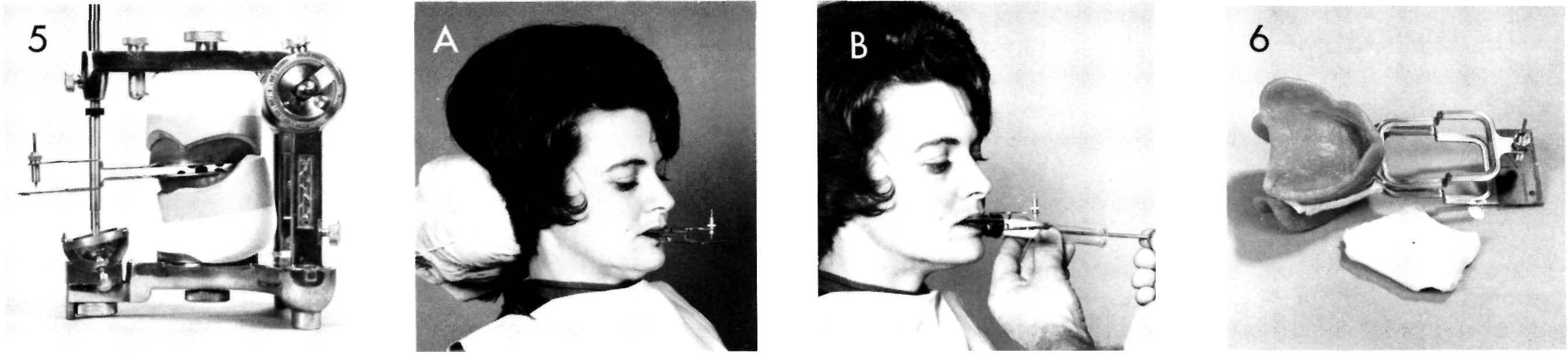 Central Bearing Devices, Pocket Dentistry