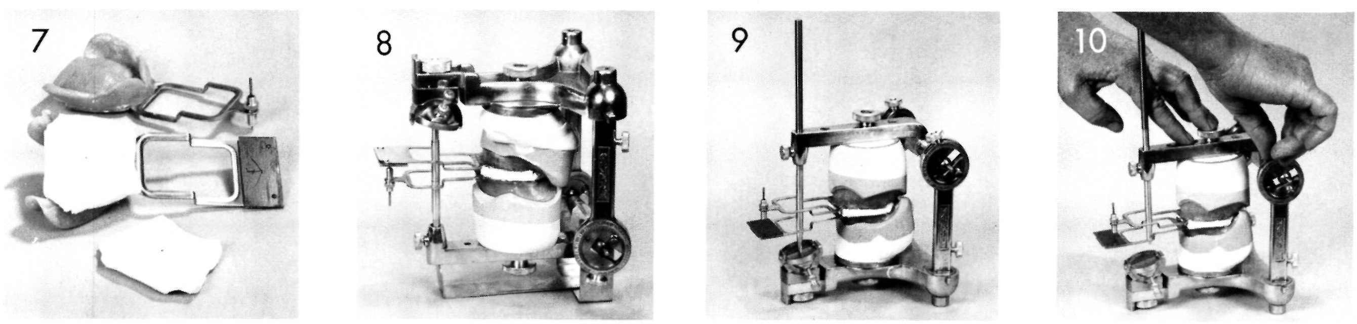 Central Bearing Devices, Pocket Dentistry