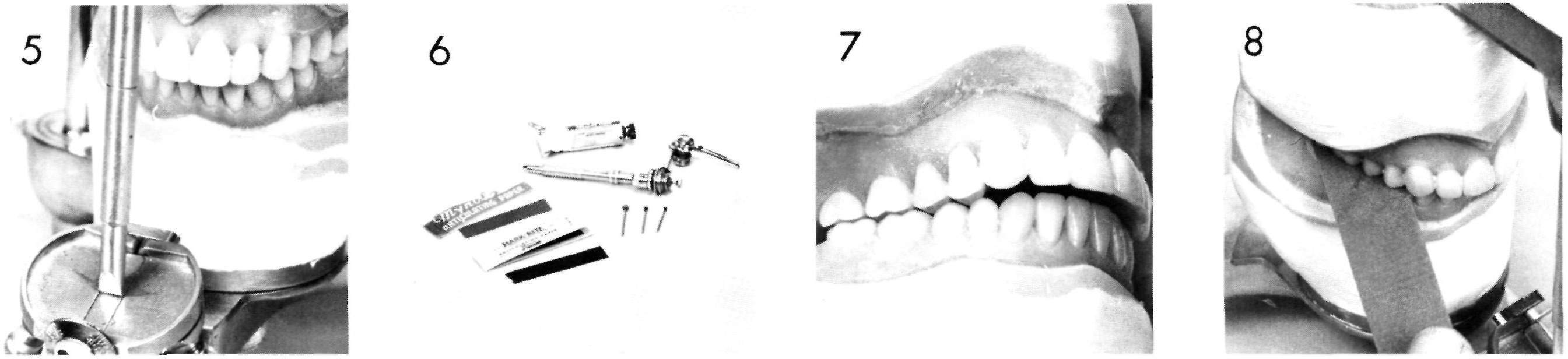 Selective Grinding and Milling, Pocket Dentistry