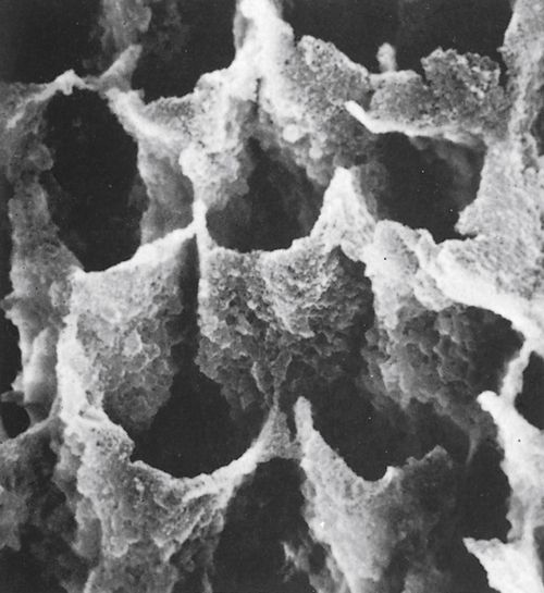 Principles of Bonding Pocket Dentistry