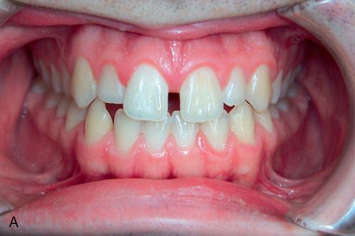 Esthetics and orthodontics Pocket Dentistry