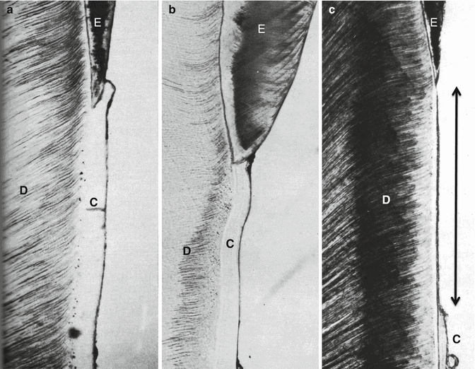 Ultrastructure of the EnamelCementum Junction Pocket Dentistry