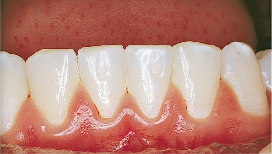 14 Periodontal Conditions Pocket Dentistry