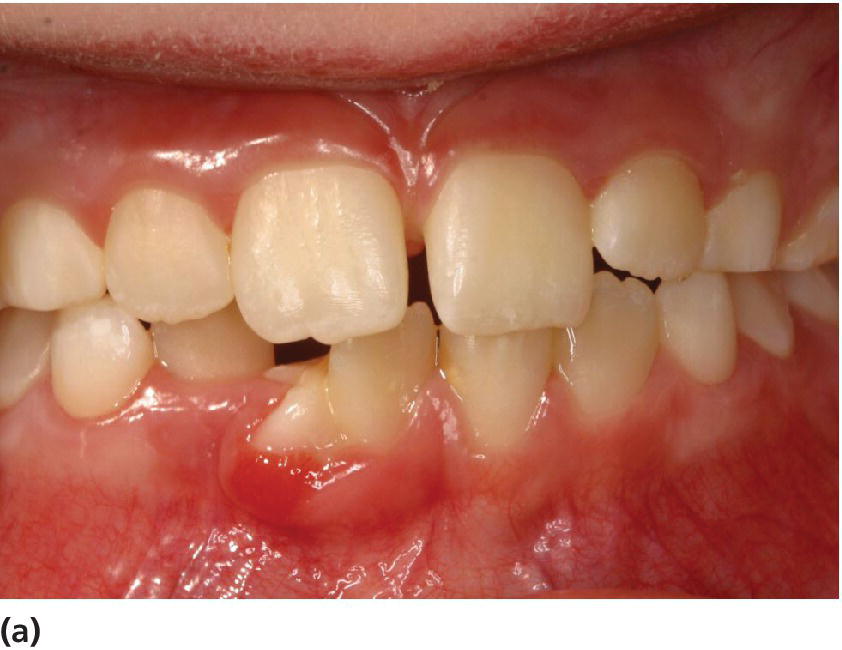 14 Periodontal Conditions Pocket Dentistry
