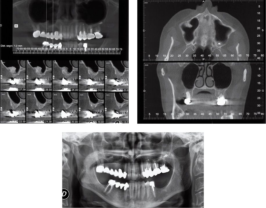 THE POSTUREOCCLUSION RELATIONSHIP AND POSTURAL ASSESSEMENT IN DENTAL
