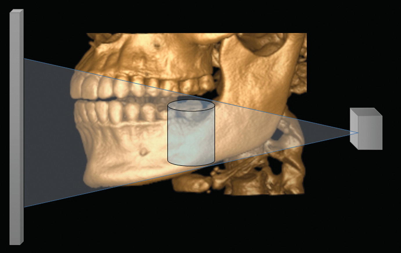 Oral Radiography | Pocket Dentistry