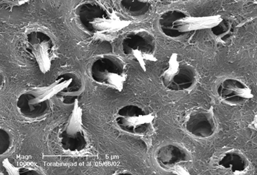 1 Pulp and Periradicular Pathways, Pathosis, and Closure Pocket Dentistry