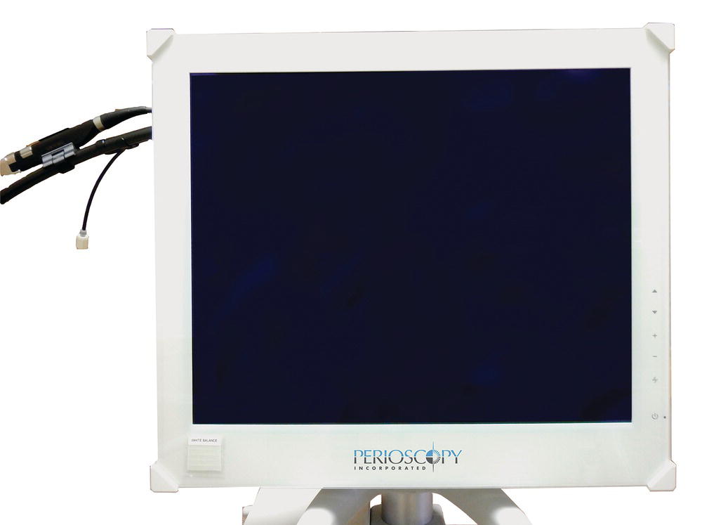 3 Ultrasonic Endoscopic Periodontal Debridement Pocket Dentistry