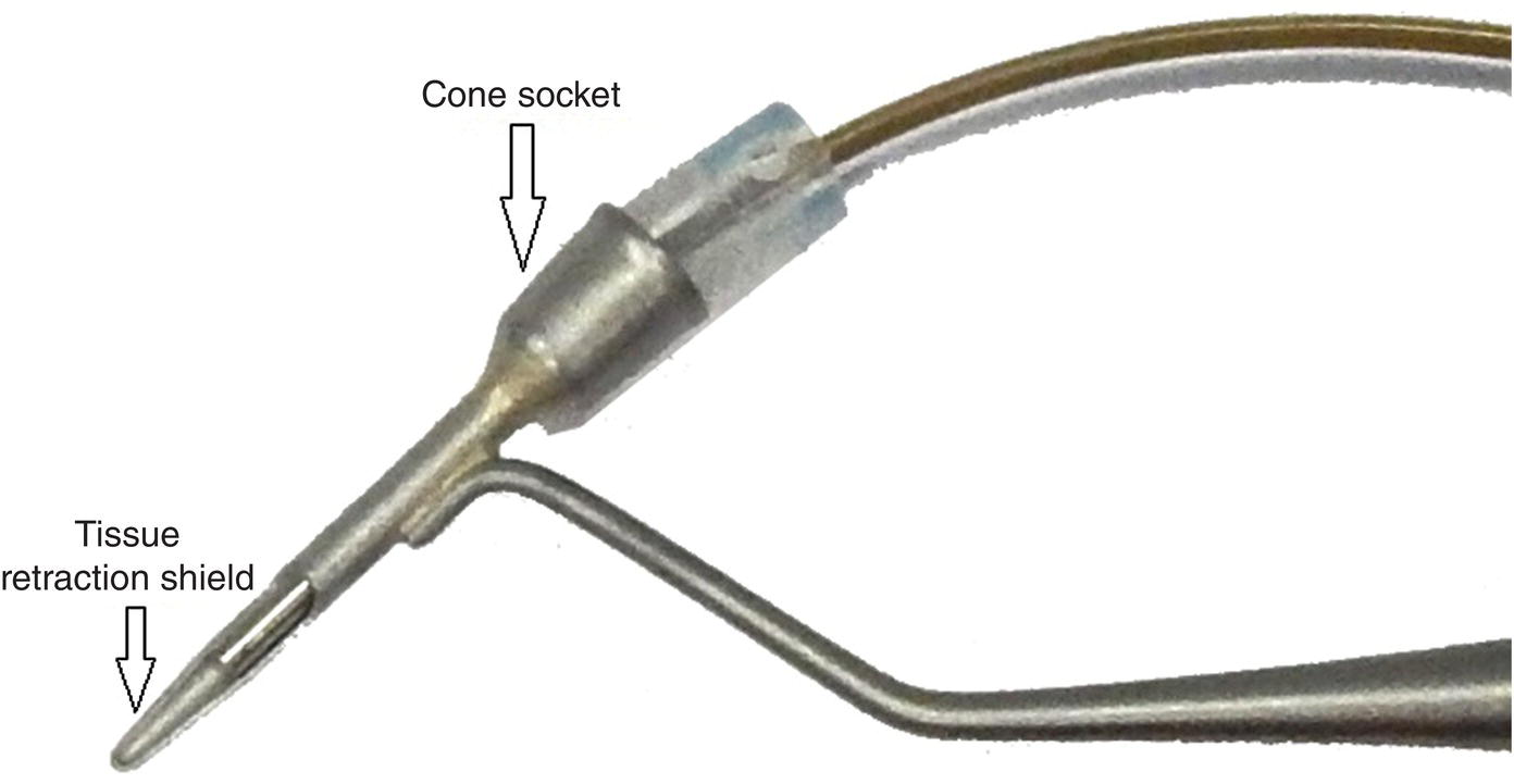 3 Ultrasonic Endoscopic Periodontal Debridement Pocket Dentistry