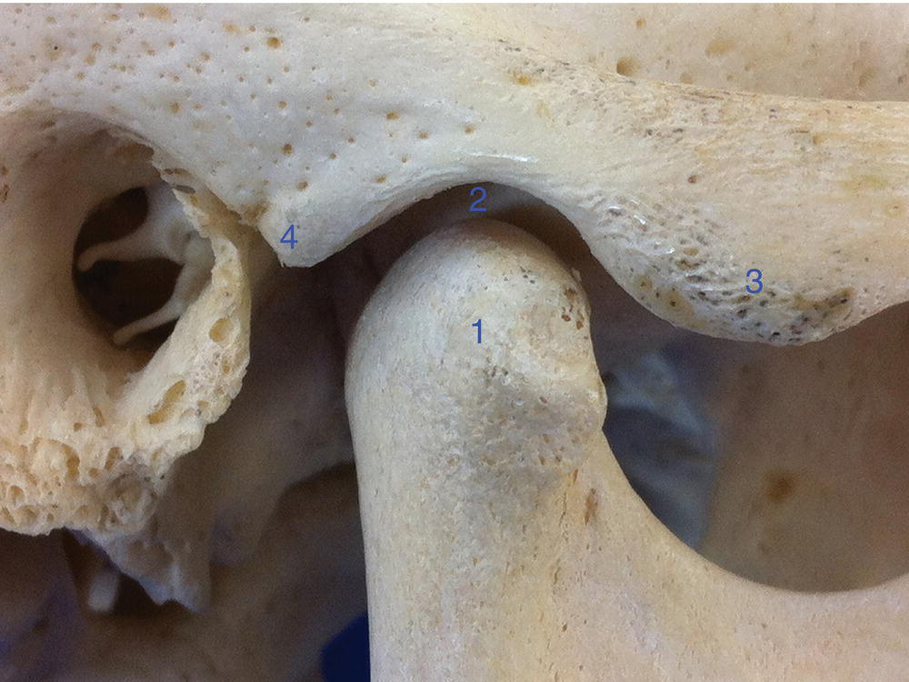 8 Temporomandibular Joint Pocket Dentistry