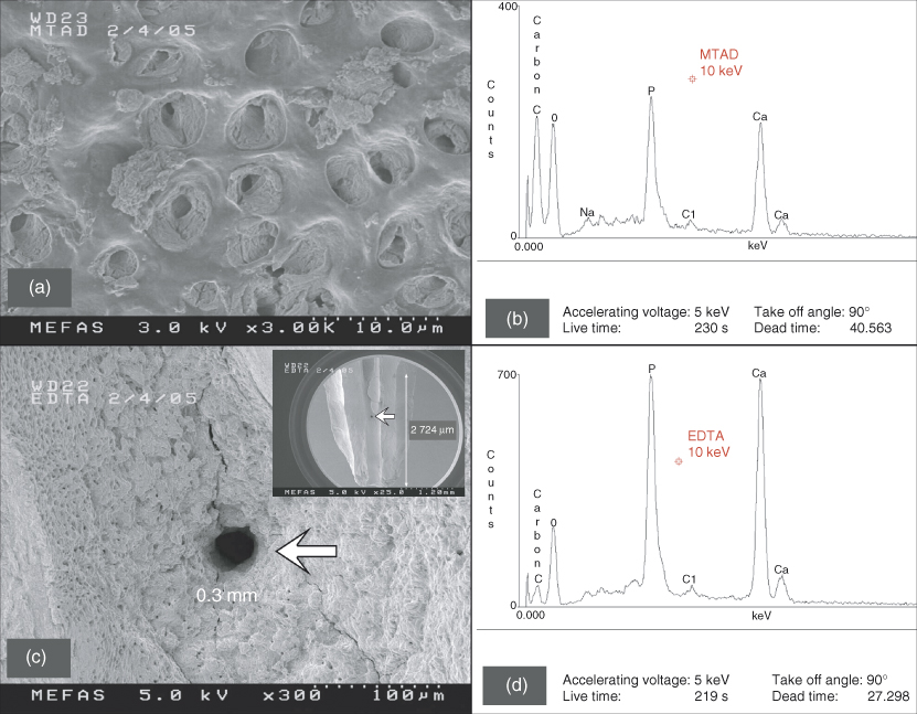 8 Fluid Dynamics of Irrigation within the Root Canal System Pocket