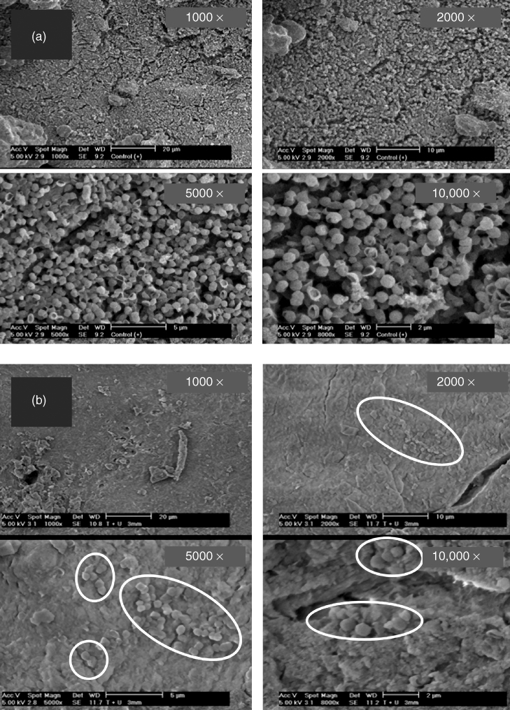 8 Fluid Dynamics of Irrigation within the Root Canal System Pocket