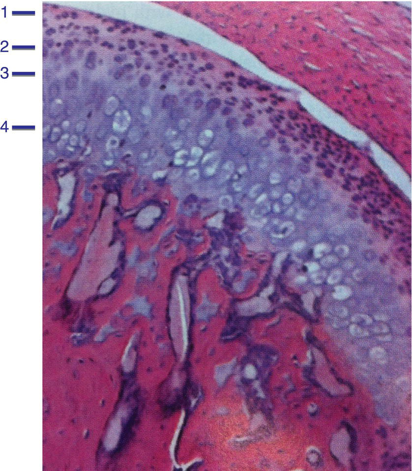 8 Temporomandibular Joint Pocket Dentistry