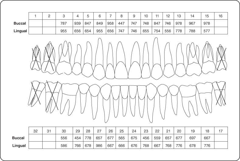 9 Preventive Periodontal Therapy Pocket Dentistry