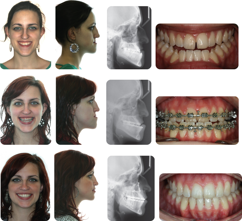 10 Orthognathic Surgery Pocket Dentistry