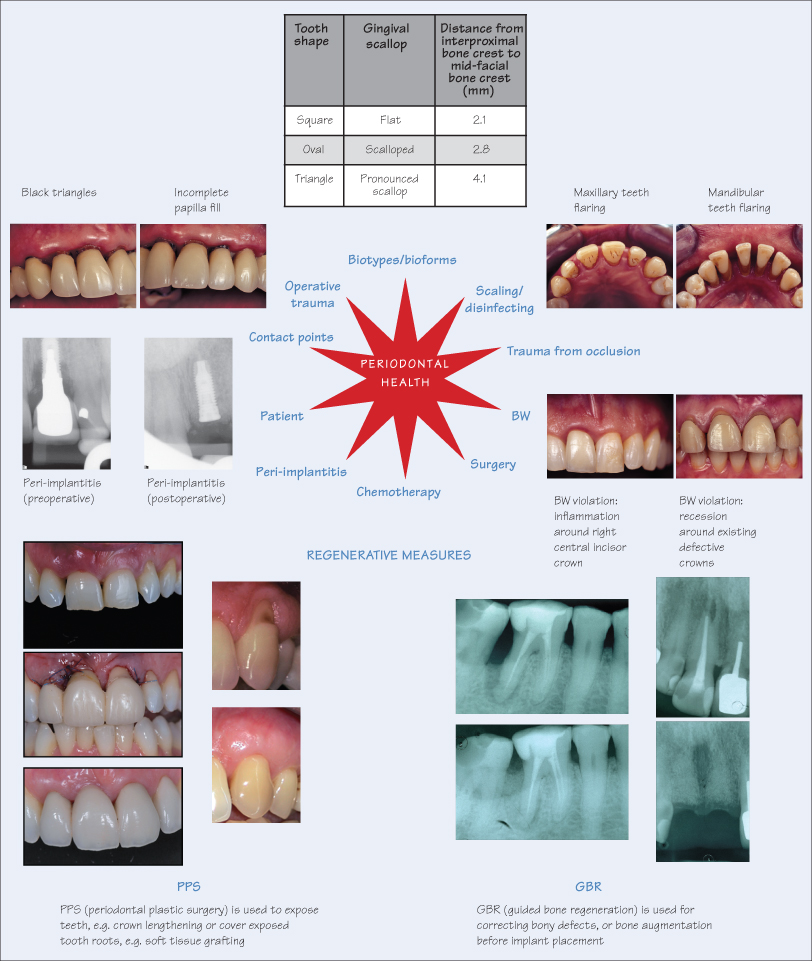 19 Prosthodontic considerations Pocket Dentistry