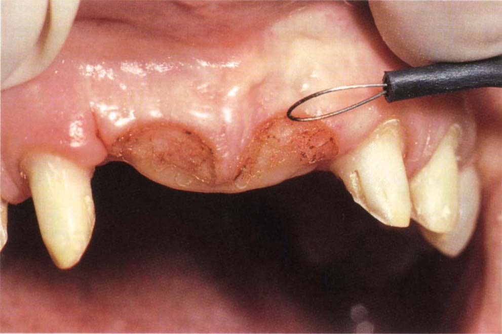 8 Premedication, Electrosurgery, Temporary and Provisional