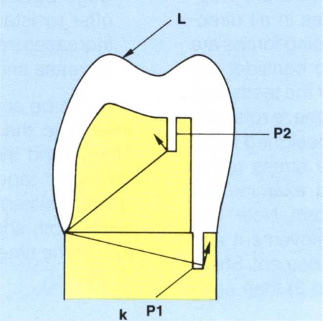 9 Tooth Preparation, Gingival Retraction, Hydrocolloid Impression