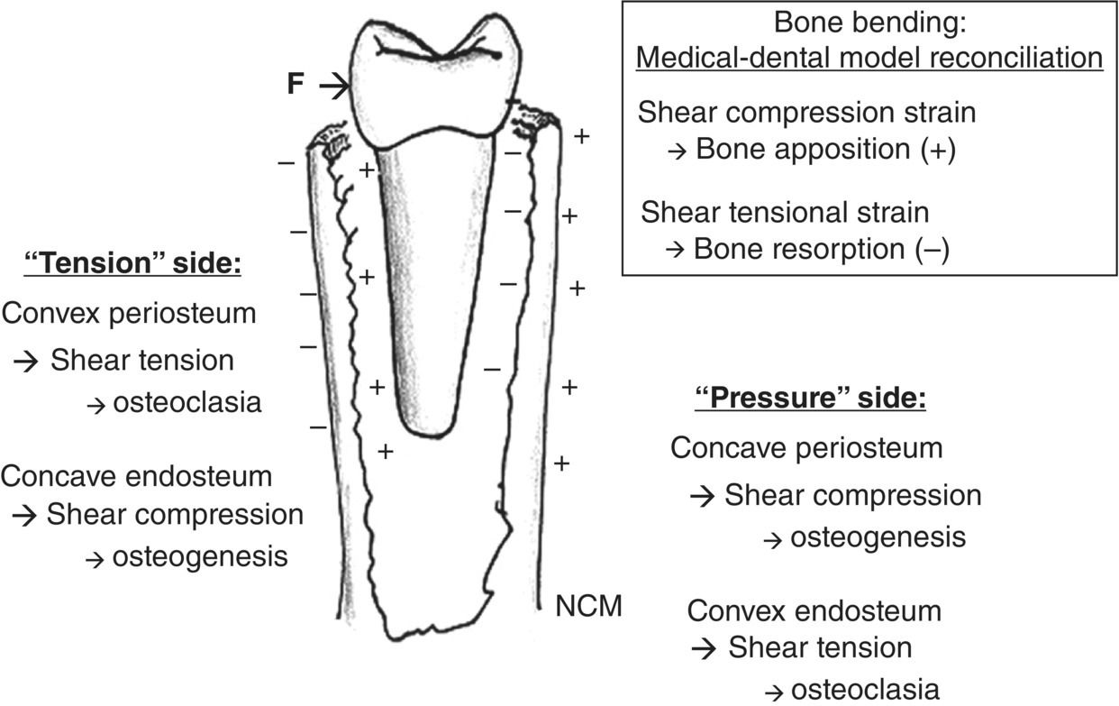 1 Corticotomyfacilitated orthodontics Pocket Dentistry