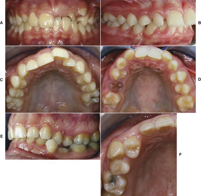 4 Orthodontic Records and Case Evaluation Pocket Dentistry