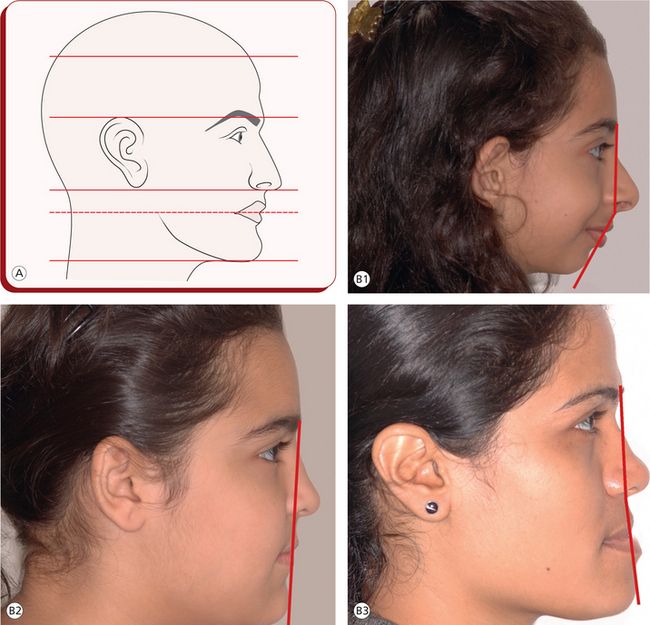 1 Craniofacial growth Pocket Dentistry