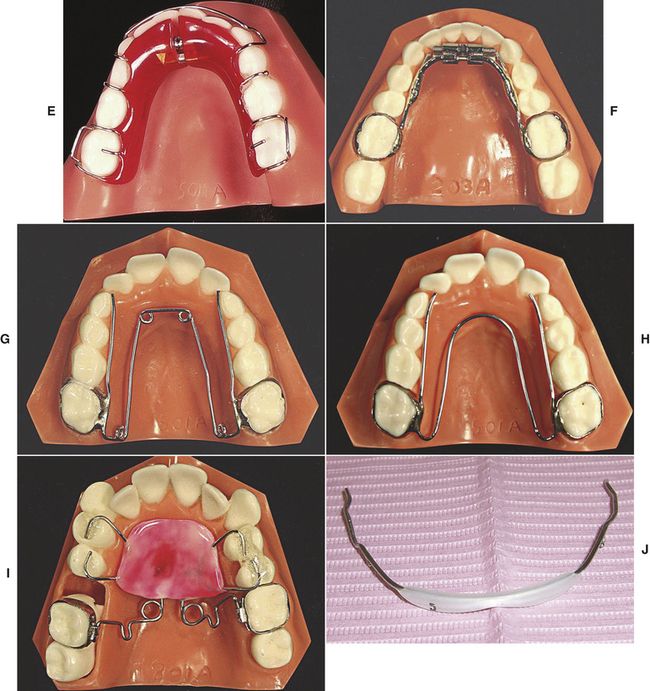 10 Treatment Tactics for Problems Related to Dentofacial Discrepancies