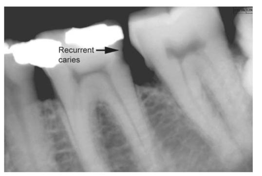 5. Cutting Instruments Pocket Dentistry