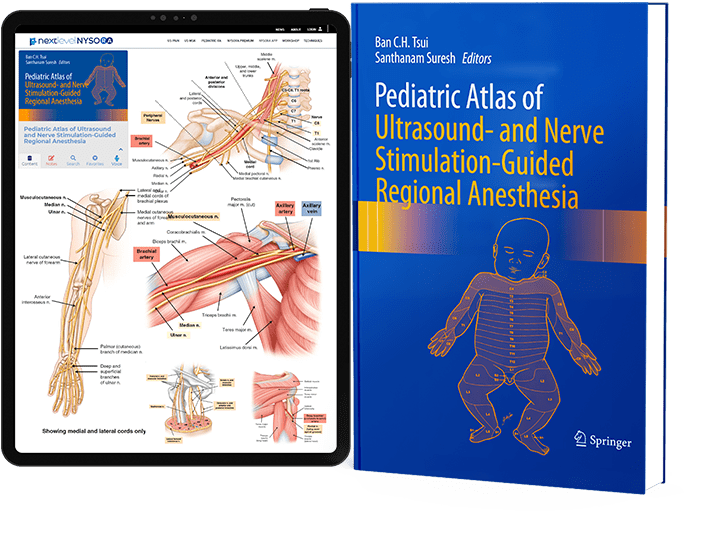 Pediatric Atlas of Ultrasound and Nerve StimulationGuided Regional