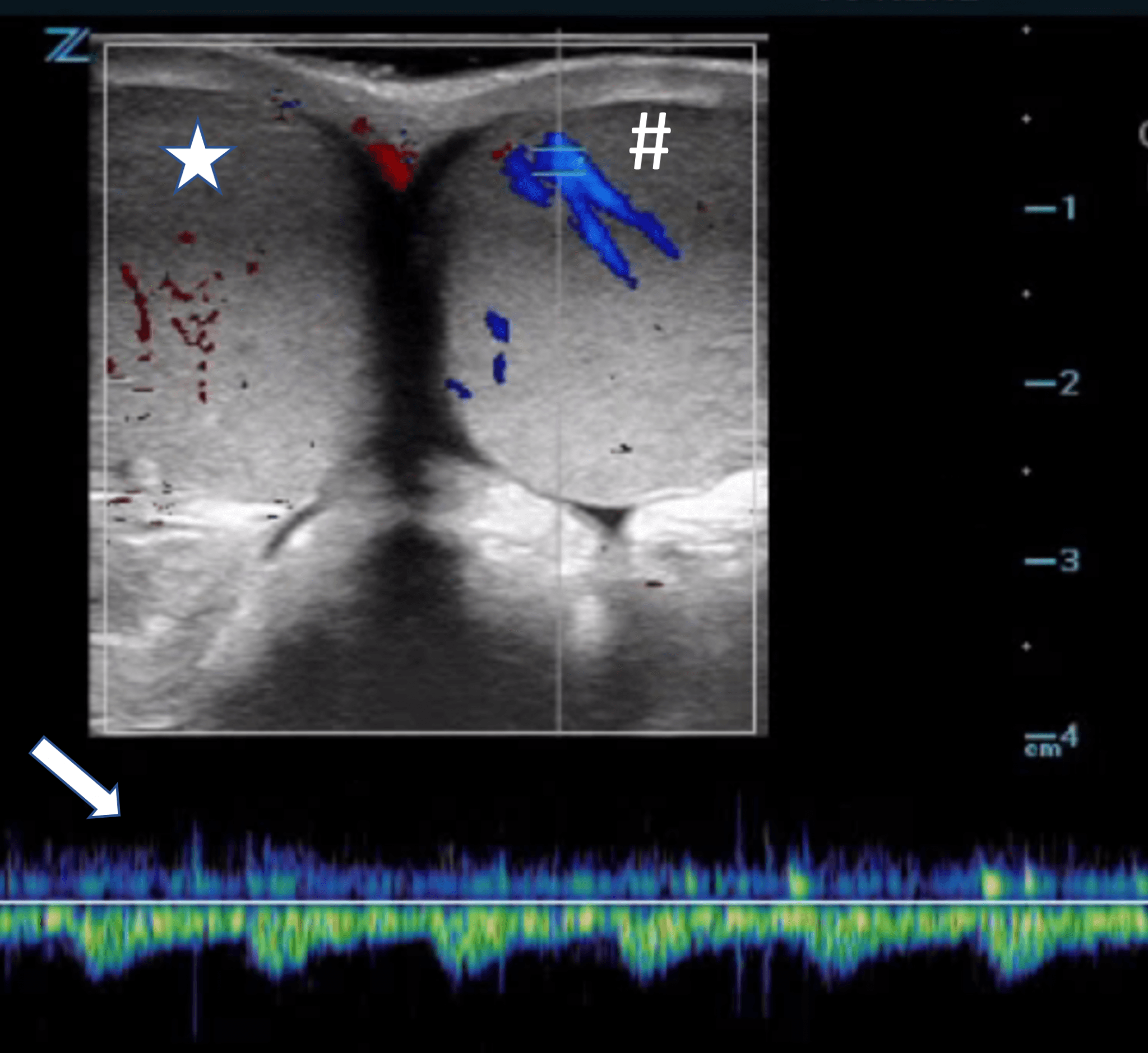 Realtime Pointofcare Ultrasound for the Diagnosis and Treatment of