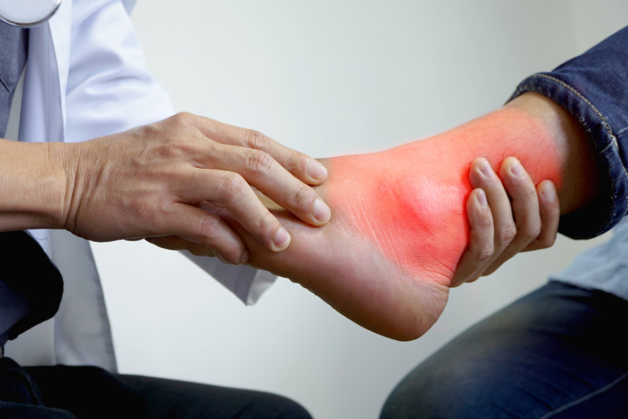 ICD 10 Tarsal Tunnel Codes Podiatry Coding