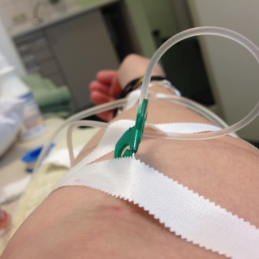 Iron infusion Clinic Sydney Book An Appointment