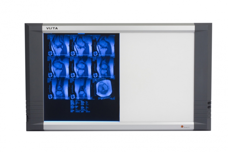 XRay Film Illuminator Point A Technologie