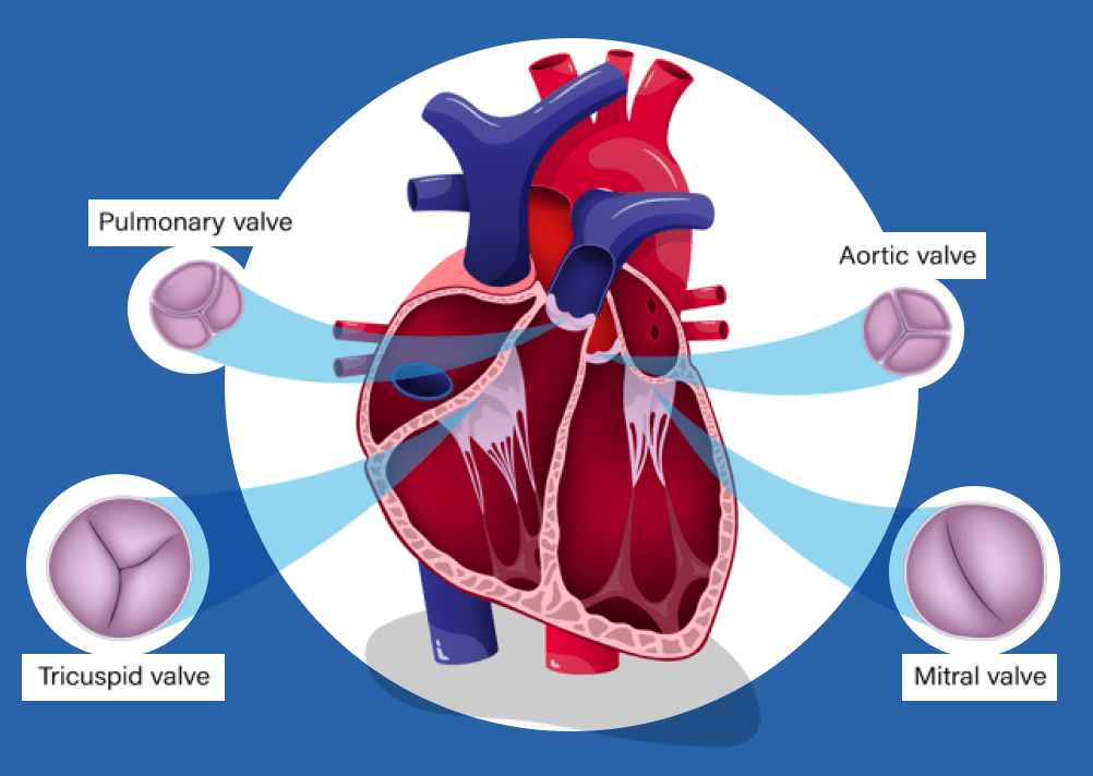 Solutions PolyVascular Inc.